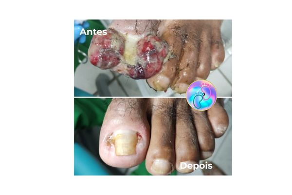 Foto de antes e depois do tratamento 44